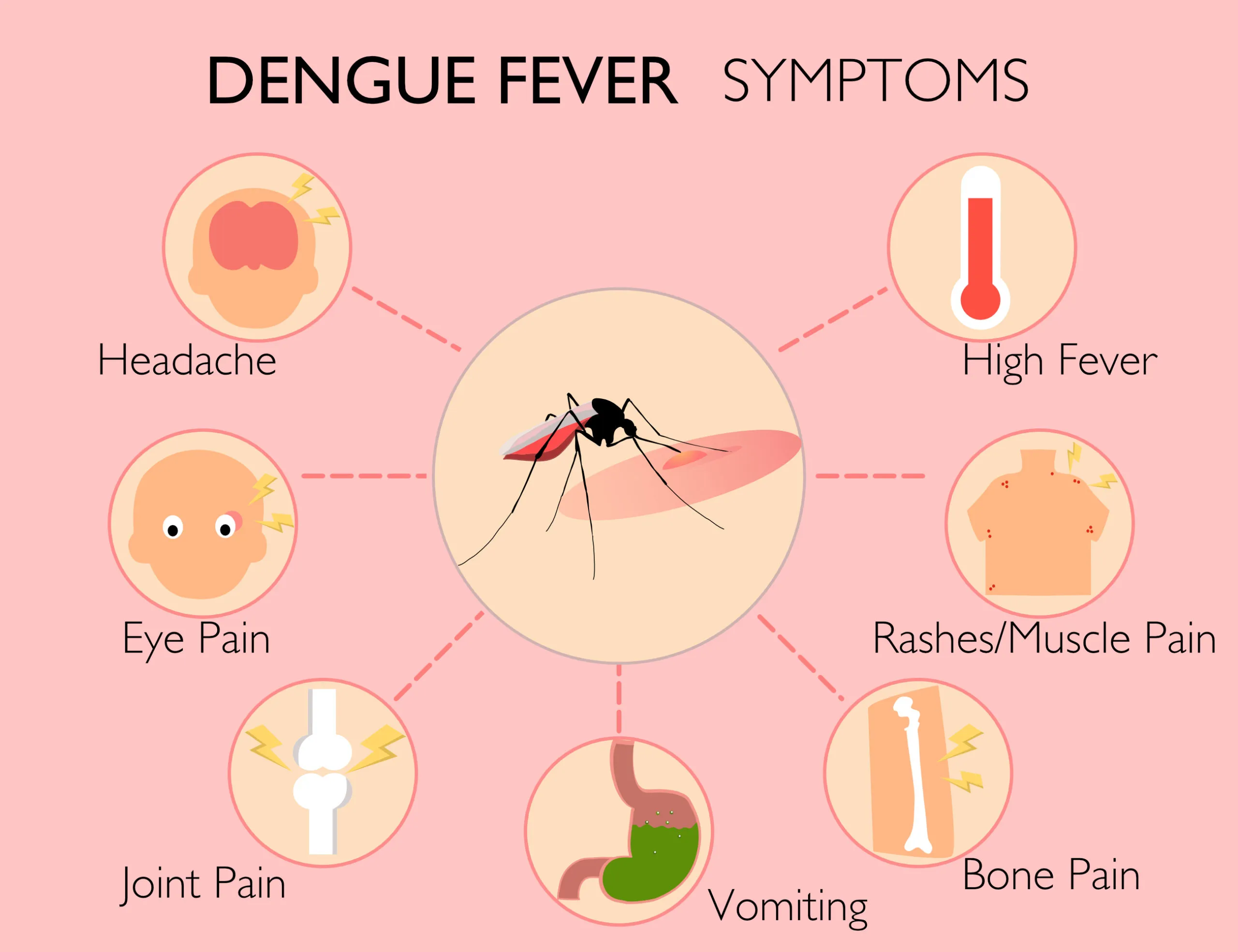 Dengue Fever Spreads Across US: The Alarming Rise of a Tropical Disease