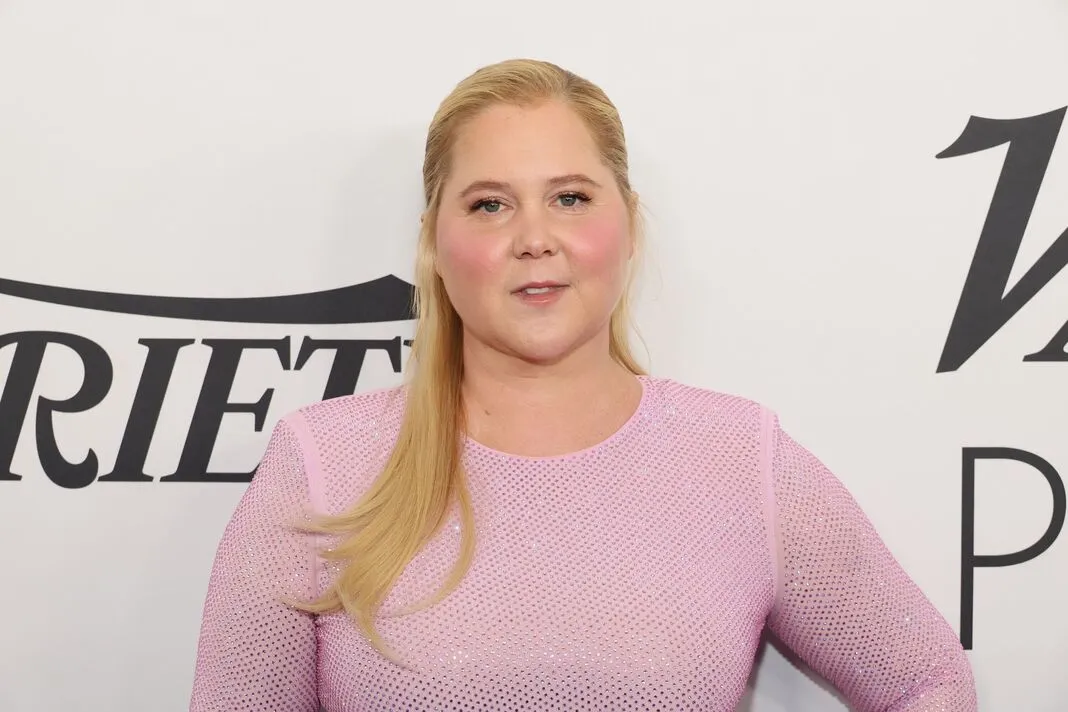 Amy Schumer's Shocking Confession: The Truth Behind Her 'Puffy' Face Revealed!