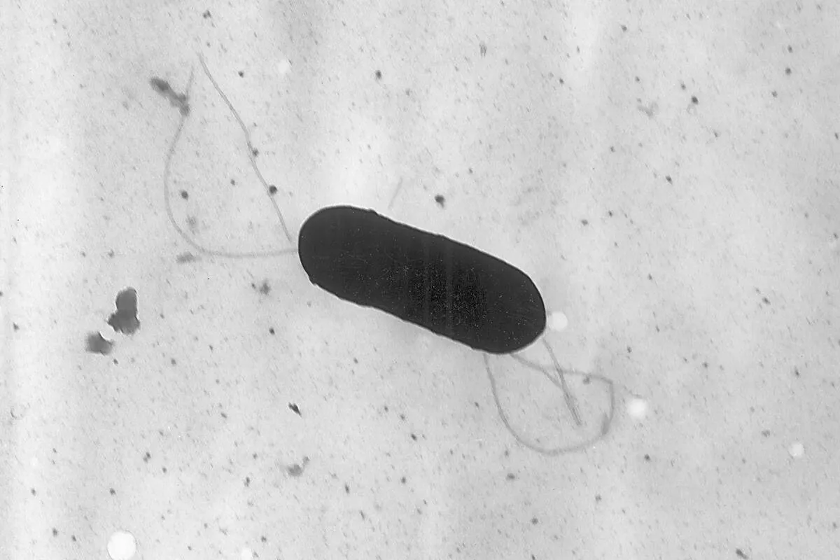 California's Listeria Outbreak: 10 Hospitalized as Ready-to-Eat Foods Recalled!