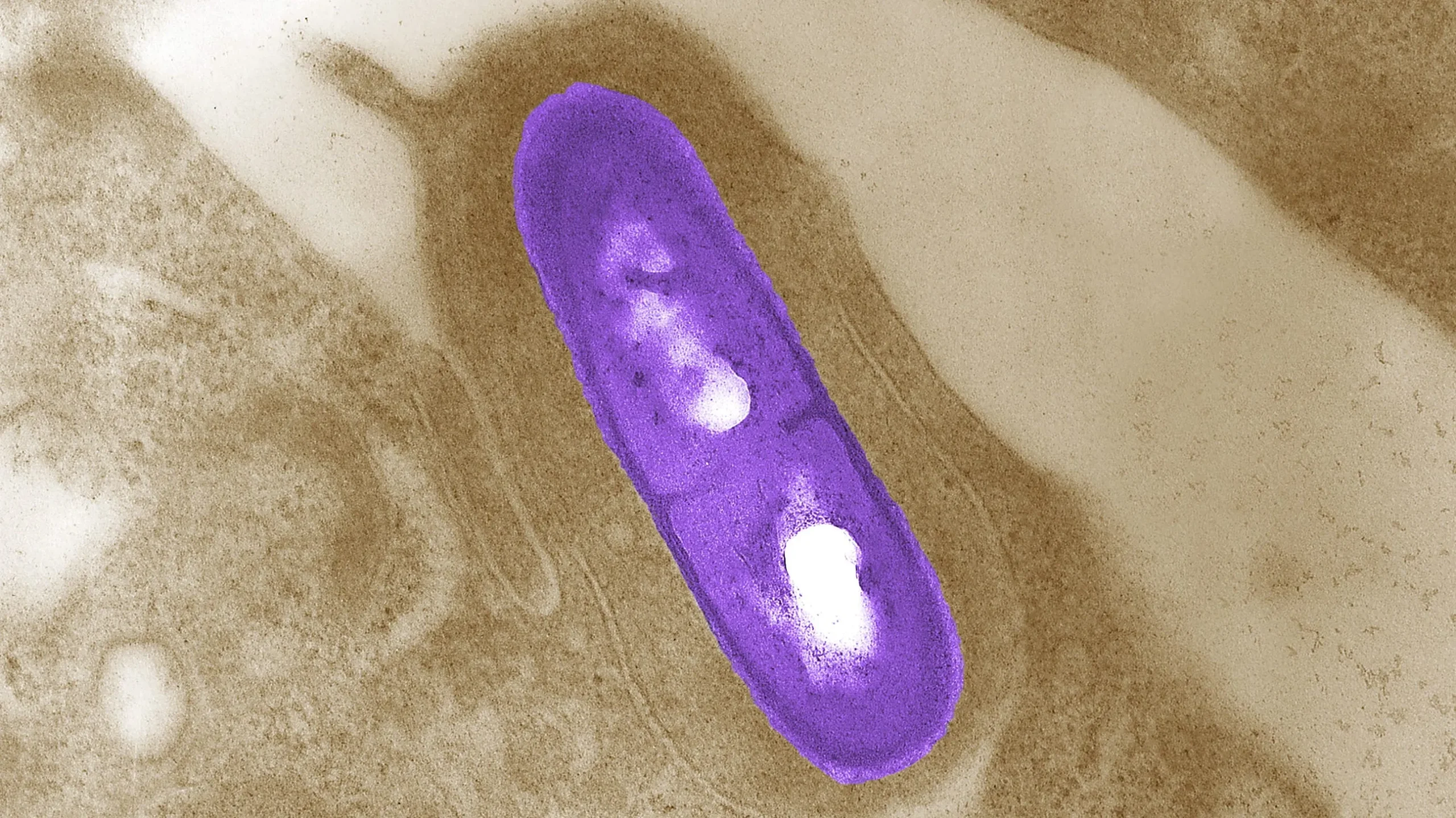 California's Listeria Outbreak: 10 Hospitalized in Alarming Food Safety Crisis